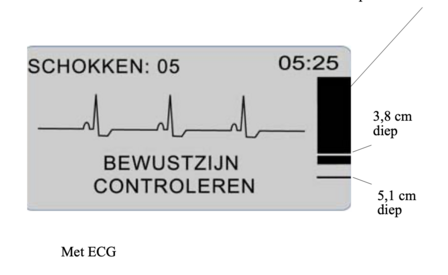 Zoll AED Plus ECG (halfautomaat)